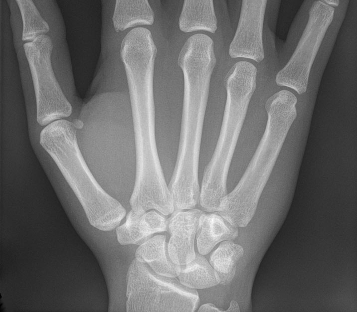 HandXRay