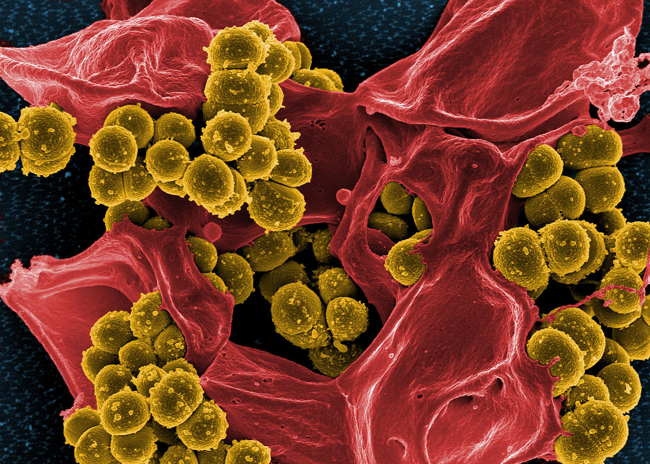 1280px-Scanning_electron_micrograph_of_Methicillin-resistant_Staphylococcus_aureus_MRSA_and_a_dead_Human_neutrophil_-_NIAID